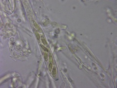 Chlorosplenium