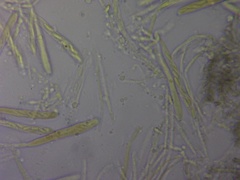 Chlorosplenium