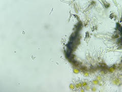 Bachmanniomyces punctum