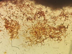 Buellia albula