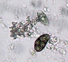 Diplotomma alboatrum