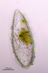 Surirella
