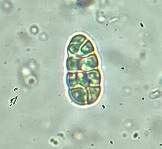 Rhizocarpon reductum