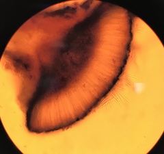 Bactrospora carolinensis