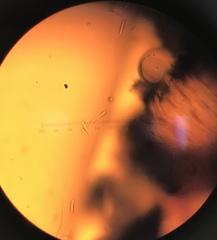 Opegrapha