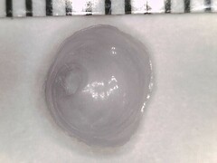 Calyptraea centralis