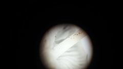 Strobilurus conigenus