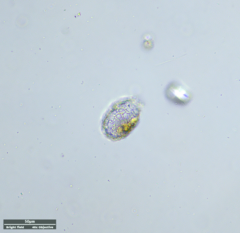 Euglyphida