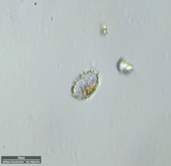 Euglyphida