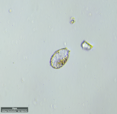 Euglyphida