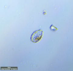 Euglyphida