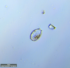 Euglyphida