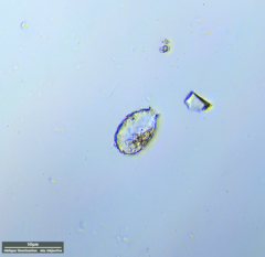 Euglyphida