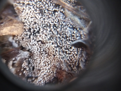 Hyphodontia