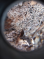 Hyphodontia