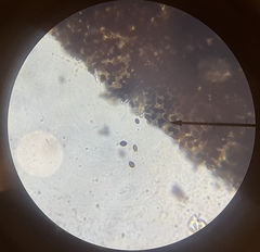 Panaeolus acuminatus