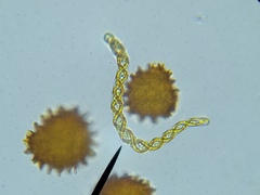 Fossombronia pusilla