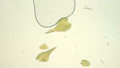 Anomodon pseudotristis