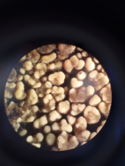 Hyphodontia