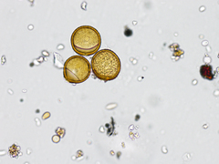 Puccinia
