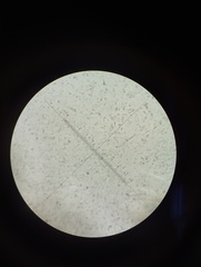 Hyphodontia