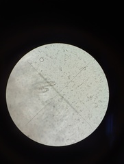 Hyphodontia