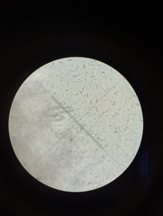 Hyphodontia
