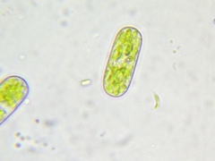 Cylindrocystis