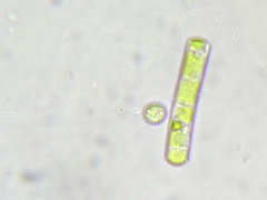 Cylindrocystis