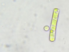 Cylindrocystis