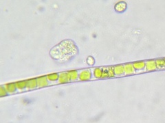 Collodictyon