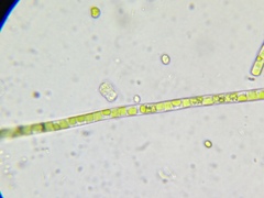 Collodictyon