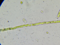 Collodictyon