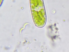 Monoraphidium contortum