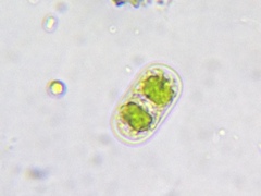 Actinotaenium cucurbita