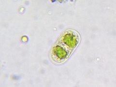 Actinotaenium cucurbita