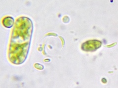 Monoraphidium contortum