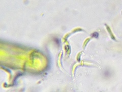 Monoraphidium contortum