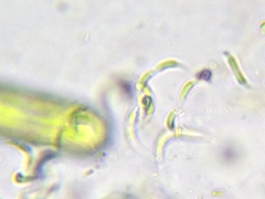 Monoraphidium contortum