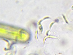 Monoraphidium contortum