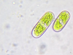 Cylindrocystis