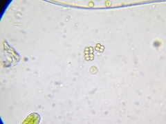 Desmococcus viridis