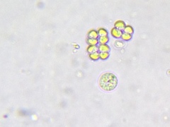 Desmococcus viridis
