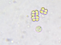 Desmococcus viridis