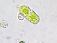 Cylindrocystis
