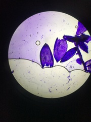 Sphagnum platyphyllum