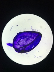 Sphagnum platyphyllum