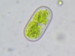 Cylindrocystis