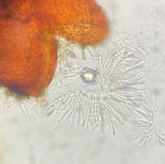 Pseudocosmospora