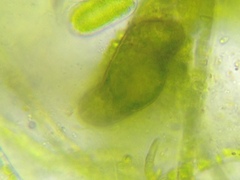 Paramecium bursaria